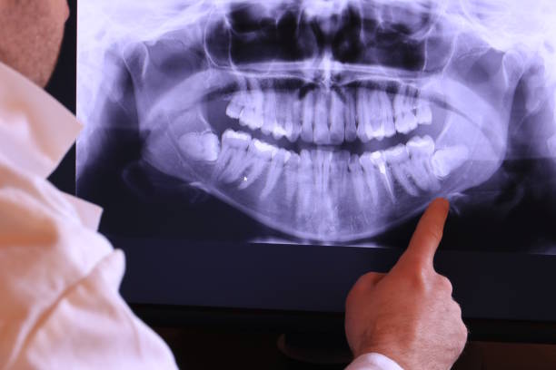Best Emergency Dental Care for Sports Injuries in Hendersonville, TN