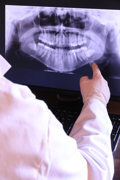 Best Emergency Care for Gum Disease in Hendersonville, TN